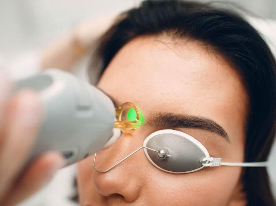 Benefits and Procedure of Laser Hair Removal for Eyebrows