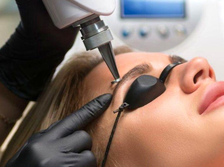 Eyebrow Laser Hair Removal: Advantages and How It Works